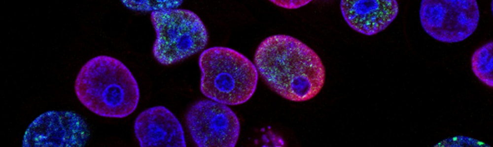 Novartis Secures $1B+ Drug Discovery Deal with Matchpoint Therapeutics
