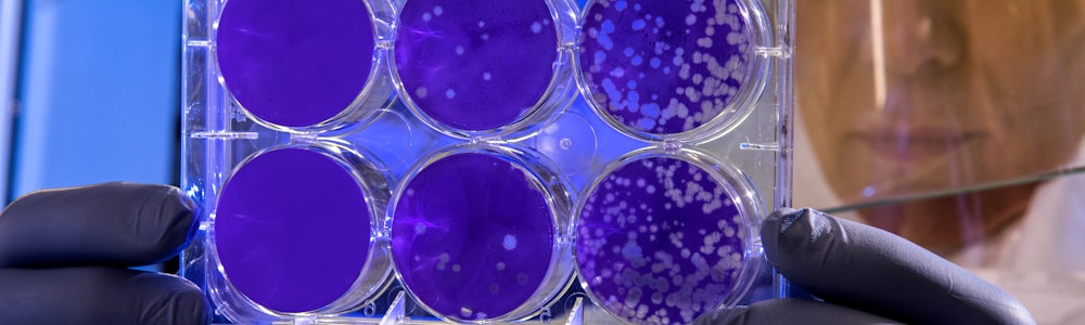 Biopharma Layoffs: Unconventional Notifications Raise Concerns in Industry